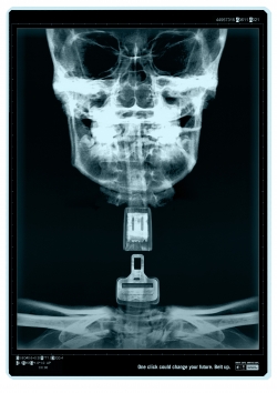Road saftey seatbelts: X-RAYS