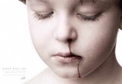 CERCA: BOY